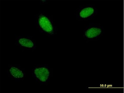 Immunocytochemistry/Immunofluorescence: FLJ10154 Antibody [H00055082-B01P] - Analysis of purified antibody to FLJ10154 on HeLa cell. (antibody concentration 10 ug/ml)