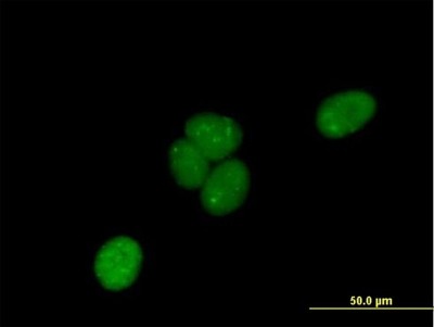 Immunocytochemistry/Immunofluorescence: LRIF1 Antibody [H00055791-B01P] - Analysis of purified antibody to C1orf103 on HeLa cell. (antibody concentration 10 ug/ml)
