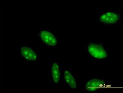 Immunocytochemistry/Immunofluorescence: GCFC2 Antibody [H00006936-B01P] - Analysis of purified antibody to C2orf3 on HeLa cell. (antibody concentration 10 ug/ml)