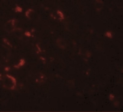 Immunocytochemistry/Immunofluorescence: Axin-1 Antibody [NBP1-76483] - Immunofluorescence of AXIN1 in human brain tissue with AXIN1 antibody at 20 ug/mL.