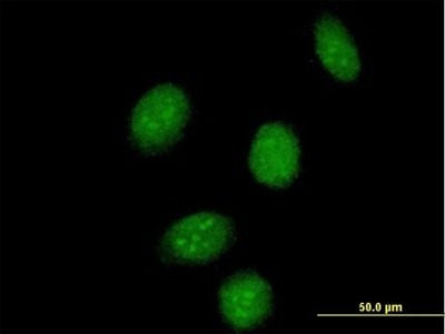 Immunocytochemistry/Immunofluorescence: SSBP2 Antibody [H00023635-B01P] - Analysis of purified antibody to SSBP2 on HeLa cell. (antibody concentration 10 ug/ml)