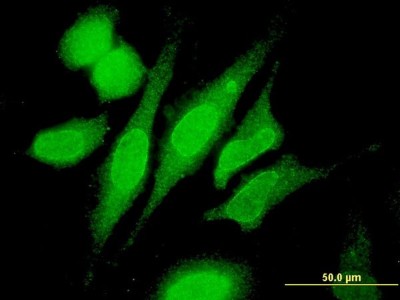 Immunocytochemistry/Immunofluorescence: RNF180 Antibody (1C4) [H00285671-M05] - Analysis of monoclonal antibody to RNF180 on HeLa cell. Antibody concentration 10 ug/ml