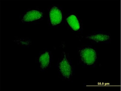 Immunocytochemistry/Immunofluorescence: UBL4A Antibody [H00008266-B01P] - Analysis of purified antibody to UBL4A on HeLa cell. (antibody concentration 10 ug/ml)