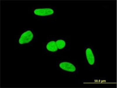 Immunocytochemistry/Immunofluorescence: INTS6 Antibody (3D9) [H00026512-M02] - Analysis of monoclonal antibody to INTS6 on HeLa cell. Antibody concentration 10 ug/ml.