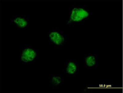 Immunocytochemistry/Immunofluorescence: RBM6 Antibody [H00010180-B01P] - Analysis of purified antibody to RBM6 on HeLa cell. (antibody concentration 10 ug/ml)