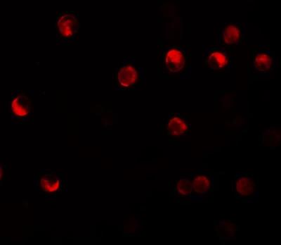 Immunofluorescence: NLRP11 Antibody [NBP1-76292] - Immunofluorescence of NALP11 in HeLa cells with NALP11 antibody at 20 ug/mL.