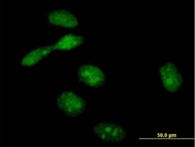 Immunocytochemistry/Immunofluorescence: EME1 Antibody [H00146956-B01P] - Analysis of purified antibody to EME1 on HeLa cell. (antibody concentration 10 ug/ml)