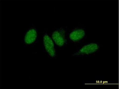 Immunocytochemistry/Immunofluorescence: MED9 Antibody [H00055090-B01P] - Analysis of purified antibody to MED9 on HeLa cell. (antibody concentration 10 ug/ml)