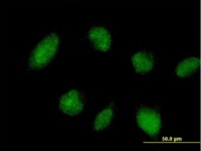 Immunocytochemistry/Immunofluorescence: TRIM45 Antibody [H00080263-B01P] - Analysis of purified antibody to TRIM45 on HeLa cell. (antibody concentration 10 ug/ml)
