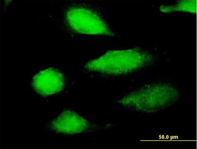 Immunocytochemistry/Immunofluorescence: EFCBP2 Antibody [H00054550-B01P] - Analysis of purified antibody to EFCBP2 on HeLa cell. (antibody concentration 10 ug/ml)
