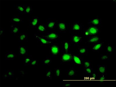 Immunocytochemistry/Immunofluorescence: PHF1 Antibody (2G7) [H00005252-M04] - Analysis of monoclonal antibody to PHF1 on HeLa cell. Antibody concentration 10 ug/ml
