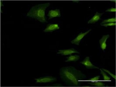 Immunocytochemistry/Immunofluorescence: TRIP1 Antibody (3B10) [H00008668-M01] - Analysis of monoclonal antibody to EIF3I on HeLa cell. Antibody concentration 10 ug/ml.