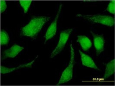 Immunocytochemistry/Immunofluorescence: TRIM47 Antibody (3C8) [H00091107-M02] - Analysis of monoclonal antibody to TRIM47 on HeLa cell. Antibody concentration 10 ug/ml.