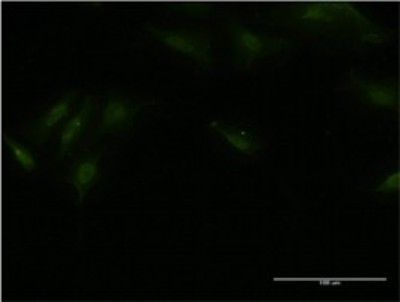 Immunocytochemistry/Immunofluorescence: BTBD9 Antibody (1G3) [H00114781-M02] - Analysis of monoclonal antibody to BTBD9 on HeLa cell. Antibody concentration 10 ug/ml.