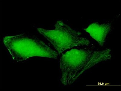 Immunocytochemistry/Immunofluorescence: THAP4 Antibody [H00051078-B01P] - Analysis of purified antibody to THAP4 on HeLa cell. (antibody concentration 10 ug/ml)