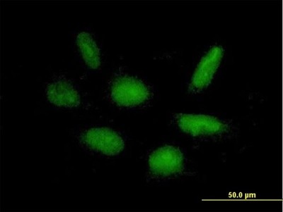 Immunocytochemistry/Immunofluorescence: RAPGEF5 Antibody [H00009771-B01P] - Analysis of purified antibody to RAPGEF5 on HepG2 cell. (antibody concentration 10 ug/ml)