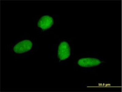 Immunocytochemistry/Immunofluorescence: Osterix/Sp7 Antibody (2G6) [H00121340-M01] - Analysis of monoclonal antibody to SP7 on HeLa cell. Antibody concentration 10 ug/ml.