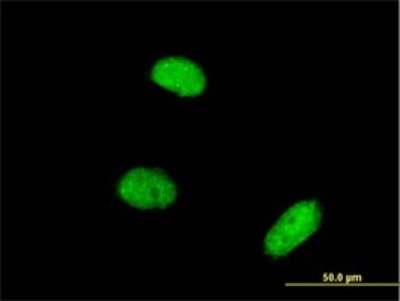 Immunocytochemistry/Immunofluorescence: Akirin2 Antibody (3D9) [H00055122-M01] - Analysis of monoclonal antibody to AKIRIN2 on HeLa cell. Antibody concentration 10 ug/ml.
