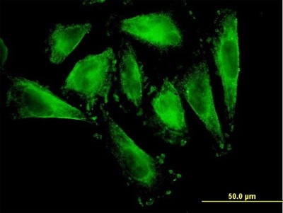 Immunocytochemistry/Immunofluorescence: RFNG Antibody (6C7) [H00005986-M08] - Analysis of monoclonal antibody to RFNG on HepG2 cell. Antibody concentration 10 ug/ml