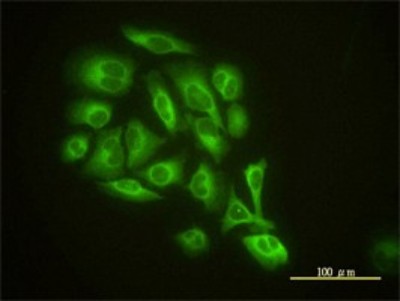 Immunocytochemistry/Immunofluorescence: GMF-beta Antibody (2G12-2A2) [H00002764-M01] - Analysis of monoclonal antibody to GMFB on HeLa cell. Antibody concentration 10 ug/ml.