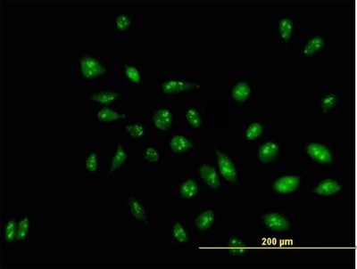 Immunocytochemistry/Immunofluorescence: RRP1 Antibody [H00008568-B01P] - Analysis of purified antibody to D21S2056E on HeLa cell. (antibody concentration 10 ug/ml)