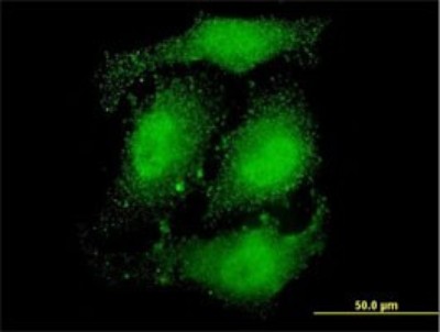 Immunocytochemistry/Immunofluorescence: ATN1 Antibody (2C10) [H00001822-M01] - Analysis of monoclonal antibody to ATN1 on HeLa cell. Antibody concentration 10 ug/ml.