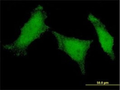 Immunocytochemistry/Immunofluorescence: MED8 Antibody (1D3) [H00112950-M01] - Analysis of monoclonal antibody to MED8 on HeLa cell. Antibody concentration 10 ug/ml.
