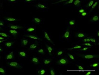 Immunocytochemistry/Immunofluorescence: Neurobeachin Antibody (3F11) [H00026960-M01] - Analysis of monoclonal antibody to NBEA on HeLa cell. Antibody concentration 10 ug/ml.
