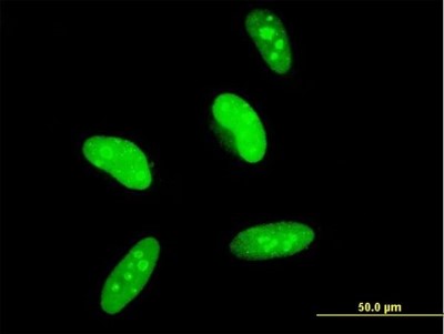 Immunocytochemistry/Immunofluorescence: MAGED2 Antibody (6G10) [H00010916-M04] - Analysis of monoclonal antibody to MAGED2 on HeLa cell. Antibody concentration 10 ug/ml