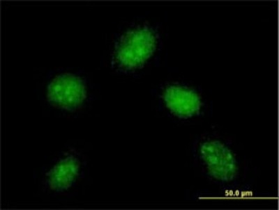 Immunocytochemistry/Immunofluorescence: DYDC1 Antibody (1B11) [H00143241-M01] - Analysis of monoclonal antibody to DYDC1 on HeLa cell. Antibody concentration 10 ug/ml.