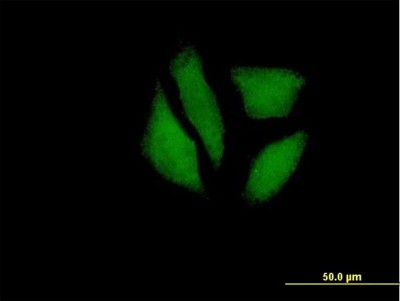 Immunocytochemistry/Immunofluorescence: MDP1 Antibody [H00145553-B01P] - Analysis of purified antibody to MGC5987 on HeLa cell. (antibody concentration 10 ug/ml)