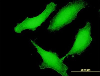Immunocytochemistry/Immunofluorescence: CCDC115 Antibody [H00084317-B01P] - Analysis of purified antibody to CCDC115 on HeLa cell. (antibody concentration 10 ug/ml)