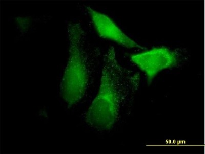 Immunocytochemistry/Immunofluorescence: Complement Factor H-related 1/CFHR1/CFHL1 Antibody [H00003078-B02P] - Analysis of purified antibody to CFHR1 on HeLa cell. (antibody concentration 10 ug/ml)