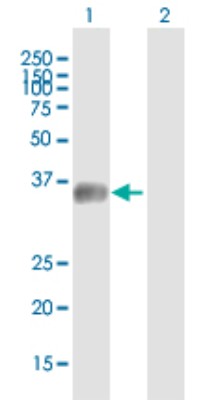 Western Blot: C5orf36 Antibody [H00285600-B01P] - Analysis of MGC34713 expression in transfected 293T cell line by MGC34713 polyclonal antibody.  Lane 1: MGC34713 transfected lysate(35.64 KDa). Lane 2: Non-transfected lysate.
