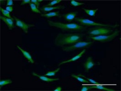 Immunocytochemistry/Immunofluorescence: IGHG1 Antibody [H00003500-D01P] - Analysis of antibody to IGHG1 on HeLa cell. Antibody concentration 30 ug/ml.