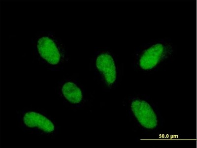 Immunocytochemistry/Immunofluorescence: PHF22 Antibody [H00057117-B01P] - Analysis of purified antibody to INTS12 on HepG2 cell. (antibody concentration 10 ug/ml)