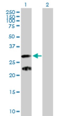Western Blot: C9orf152 Antibody [H00401546-B01P] - Analysis of C9orf152 expression in transfected 293T cell line by C9orf152 polyclonal antibody.  Lane 1: C9orf152 transfected lysate(23.98 KDa). Lane 2: Non-transfected lysate.