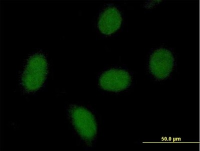 Immunocytochemistry/Immunofluorescence: C9orf152 Antibody [H00401546-B01P] - Analysis of purified antibody to C9orf152 on HeLa cell. (antibody concentration 10 ug/ml)