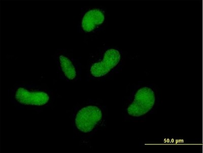 Immunocytochemistry/Immunofluorescence: ZNF350 Antibody [H00059348-B01P] - Analysis of purified antibody to ZNF350 on HepG2 cell. (antibody concentration 10 ug/ml)