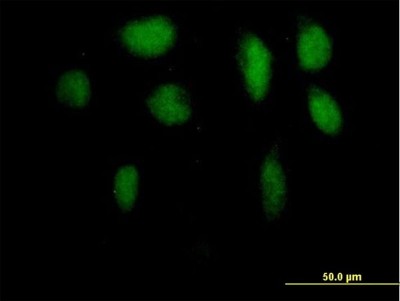 Immunocytochemistry/Immunofluorescence: ZFP95 Antibody [H00023660-B01P] - Analysis of purified antibody to ZFP95 on HeLa cell. (antibody concentration 10 ug/ml)