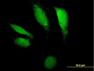 Immunocytochemistry/Immunofluorescence: DNase II Antibody [H00001777-B01P] - Analysis of purified antibody to DNASE2 on HeLa cell. (antibody concentration 10 ug/ml)