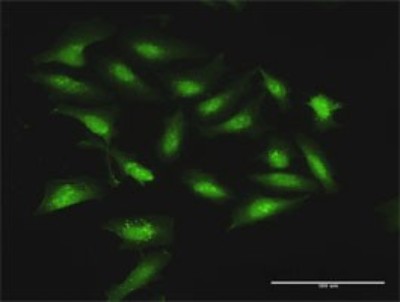 Immunocytochemistry/Immunofluorescence: Stomatin Antibody [H00002040-D01P] - Analysis of antibody to STOM on HeLa cell. Antibody concentration 10 ug/ml.