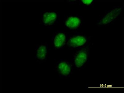 Immunocytochemistry/Immunofluorescence: EED Antibody [H00008726-B01P] - Analysis of purified antibody to EED on HeLa cell. (antibody concentration 10 ug/ml)