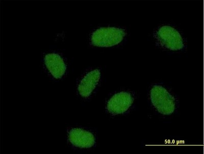 Immunocytochemistry/Immunofluorescence: REM2 Antibody [H00161253-B01P] - Analysis of purified antibody to FLJ38964 on HeLa cell. (antibody concentration 10 ug/ml)