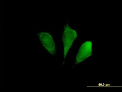 Immunocytochemistry/Immunofluorescence: FBX09 Antibody [H00026268-B01P] - Analysis of purified antibody to FBXO9 on HeLa cell. (antibody concentration 10 ug/ml)