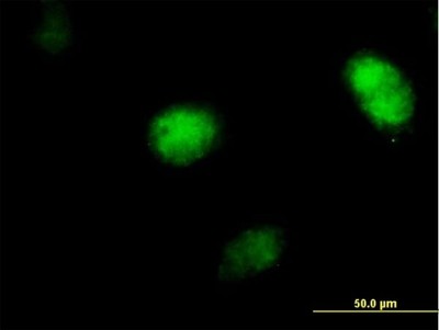 Immunocytochemistry/Immunofluorescence: XPV/DNA polymerase eta Antibody [H00005429-B01P] - Analysis of purified antibody to POLH on HeLa cell. (antibody concentration 10 ug/ml)