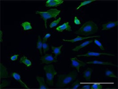 Immunocytochemistry/Immunofluorescence: UMPS Antibody (2B10) [H00007372-M06] - Analysis of monoclonal antibody to UMPS on HeLa cell. Antibody concentration 10 ug/ml