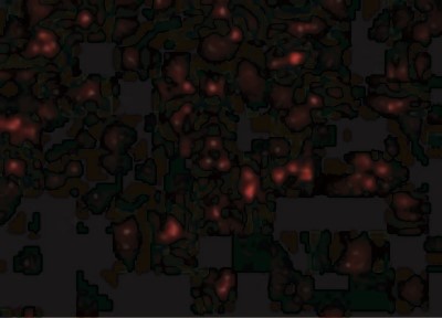 Immunocytochemistry/Immunofluorescence: NLRP1/NALP1 Antibody [NBP1-76656] - Immunofluorescence of NALP1 in K562 cells with NALP1 antibody at 20 ug/mL.