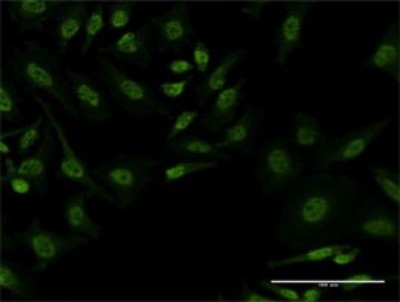Immunocytochemistry/Immunofluorescence: FBXL19 Antibody (3C5) [H00054620-M03] - Analysis of monoclonal antibody to FBXL19 on HeLa cell. Antibody concentration 10 ug/ml