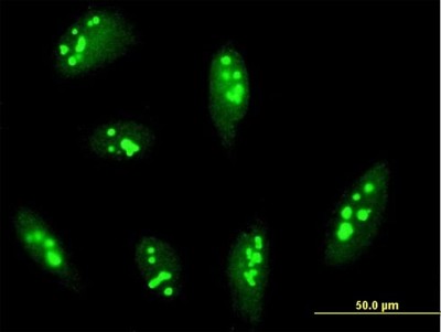 Immunocytochemistry/Immunofluorescence: RRP12 Antibody [H00023223-B01P] - Analysis of purified antibody to RRP12 on HeLa cell. (antibody concentration 10 ug/ml)
